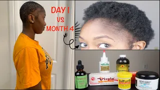 DETAILED 4 MONTH BIG CHOP UPDATE | LENGTH + EDGE UPDATE +DOO GRO, SULFUR 8, JBCO, WILD GROWTH REVIEW