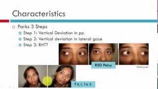 IV CN Palsy Acquired Unilateral