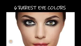 6 Rarest Eye Colors in Humans | The Rarest Eye Colors in the World?