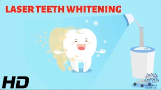 Laser Teeth Whitening: The Safe and Effective Way to Whiten Your Teeth