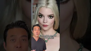 Analyzing Anya Taylor-Joy's face. #plasticsurgery #medspa #plasticsurgeon #anyataylorjoy