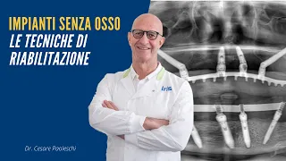 Implantologia dentale senza osso: intervista al dr. Cesare Paoleschi