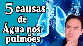 5 causas de agua no pulmao - edema agudo pulmonar