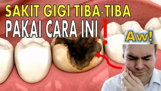 Ini PERTOLONGAN PERTAMA SAAT SAKIT GIGI di rumah ‼️