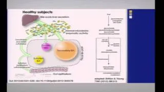 The Microbiome in Infectious and Noninfectious Gut Inflammation - Vince Young