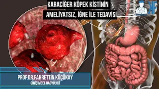 Köpek kistinin ameliyatsız iğne ile tedavisi