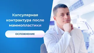 ОСЛОЖНЕНИЕ Капсулярная контрактура после маммопластики Пластический хирург Андрей Анеликов