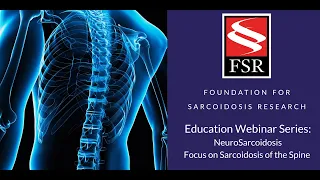 Education Webinar Series: Sarcoidosis of the Spine