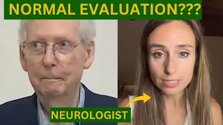 McConnell's Spells with 'Normal' Workup | Neurologist Explains