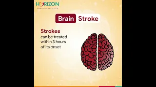 Brain stroke treatment | Patient review | Horizon Hospital