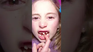 Giorgia ha paura di staccarsi il dente da sola e Papà Salvo l'aiuta! #salvoegiorgia #shorts