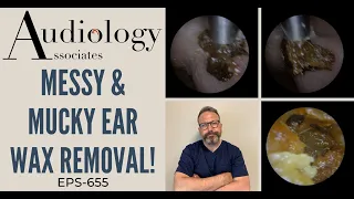 MESSY & MUCKY EAR WAX REMOVAL - EP655