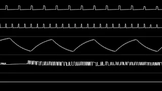 “Battletoads & Double Dragon - The Ultimate Team (NES)” Full Soundtrack [Oscilloscope View]