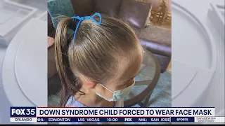 Father of child with Down syndrome says mask was tied around his daughter's head