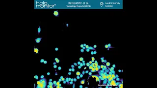 JIMT-1 spheroid cell migration imaged for 72 hours | Rafnsdóttir et al. (2023) | HoloMonitor®
