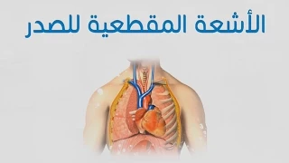 الأشعة المقطعية للصدر