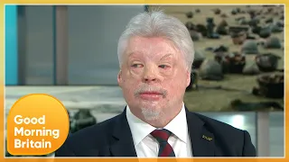 Simon Weston, The Most Seriously Injured Survivor Of The Falklands Conflict, Tells His Story | GMB