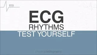 ECG Rhythms for self-assessment: Test ECG Interpretation Skills