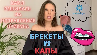 Как я решилась на Invisalign I Мой опыт исправления прикуса