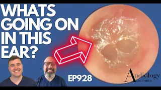 WHATS GOING ON IN THIS EAR? - EP928