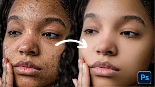 Skin Retouching - Best Photoshop Tutorial | Face Retouching