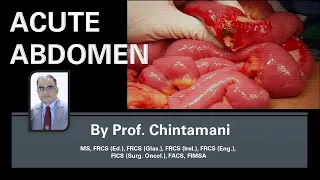 Acute Abdomen - Etiopathogenesis, Diagnosis and Management by Prof. Chintamani