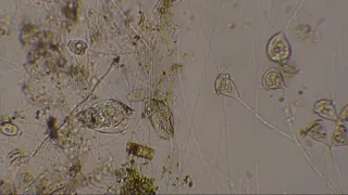 Rotifer (Rotatoria)/Kerekesféreg