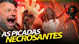 AS PICADAS NECROSANTES DAS ARANHAS BRASILEIRAS! | RICHARD RASMUSSEN