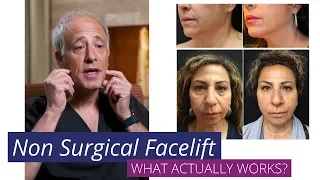 Facelift Alternatives: NonSurgical Facelift Treaments You Need to Know About #NonSurgicalFacelift