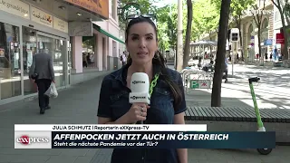 Affenpocken jetzt auch in Österreich! Steht die nächste Pandemie vor der Tür?