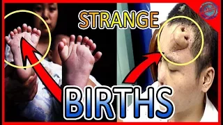 Top 5 people who was born with extra body parts | people with more then one nose, head, and mouth✔