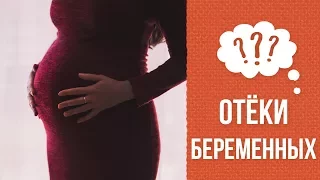 Почему возникают отеки при беременности