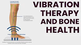 Does Vibration Therapy Improve Osteoporosis?