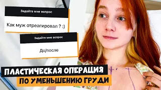 Операция по уменьшению груди: Как отреагировал муж, ДО/ПОСЛЕ, шрамы