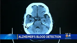 New Blood Test May Help Detect Alzheimer's Disease Early