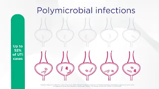 Bacterial Interactions and Impact on Antibiotic Susceptibility and Resistance