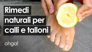 Rimedi naturali per calli e talloni screpolati: dal bicarbonato all'aceto di vino