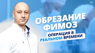 Как проходит урологическая операция? Лечение фимоза без рубцов и боли