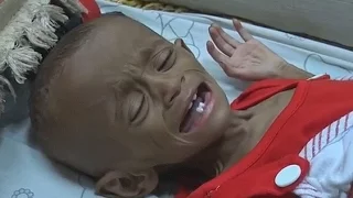 ООН: голода в Йемене удалось избежать, но ситуация тяжёлая (новости)