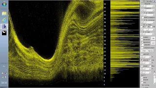 ROV Гидролокатор (SONAR)