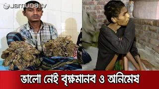 বৃক্ষমানব ও জলেভাসা অনিমেষর করোনাকালীন জীবন | Jamuna TV