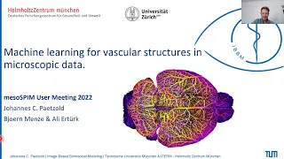 Johannes Paetzold: Machine learning for vascular structures in microscopic data.