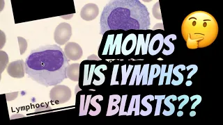 How I distinguish between Lymphocytes vs Monocytes