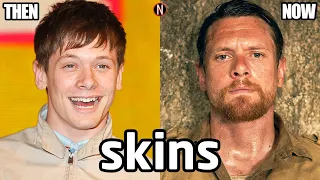 Skins UK (2007-13 vs 2024) Cast ★ Then and Now - 17 Years Later