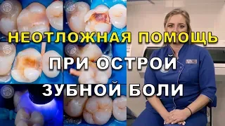 Острая зубная боль в зубе – что делать и как избавиться? (Видео) Люми-Дент Киев (Зубний біль)