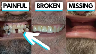 3 Men, 24 Hrs: Life-Changing Teeth Transformations