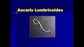 Ascaris lumbricoid in Amharic