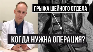 Cervical disc herniation, spinal cord compression and cervical myelopathy