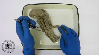 Спланхнология, анатомия трахеи