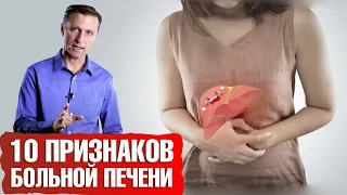 10 признаков умирающей печени ☠️ Печеночная недостаточность